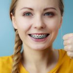 How to Care for Your Braces Over the Holiday Break