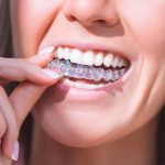 10 Unique Benefits of Invisalign at Crescent Orthodontics in South Lyon, MI