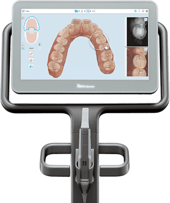 Crescent Smile 3D – South Lyon, MI Crescent Smile 3D - South Lyon, MI